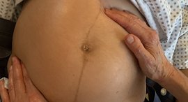 Babybauch 